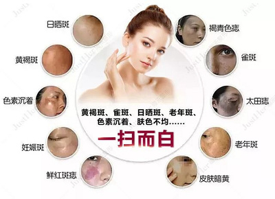 黑科时代 让“满脸长斑”的你，在杭州遇见最美的自己